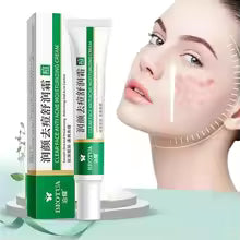 Acne treatment cream